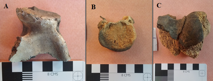 Porcentaje y tipo de tejido termoalterado. A. Fragmento de omóplato adulto totalmente termoalterado. B. Vértebra dorsal con evidencia de termoalteración mínima. C. Epífisis distal de fémur con presencia de tejido cortical quemado y tejido esponjoso sin alterar.